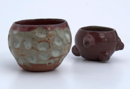 Kathryn Baczeski, She Has Inverted Nipples & Need Some Lanolin